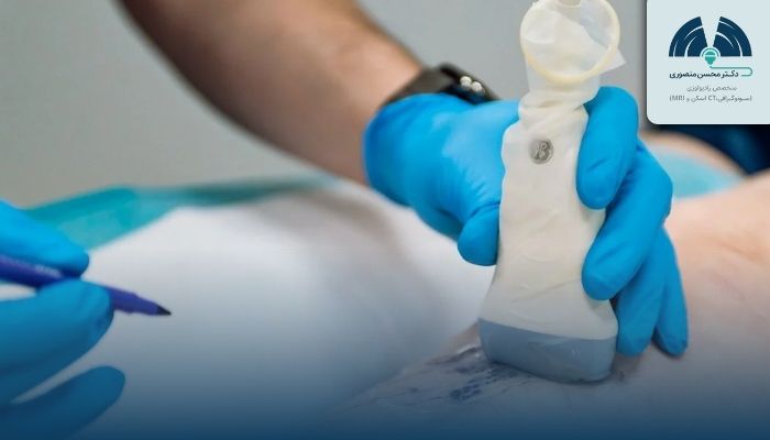 سونوگرافی داپلر چیست و چه کاربردی دارد؟ سونوگرافی داپلر چیست و چه کاربردی دارد؟