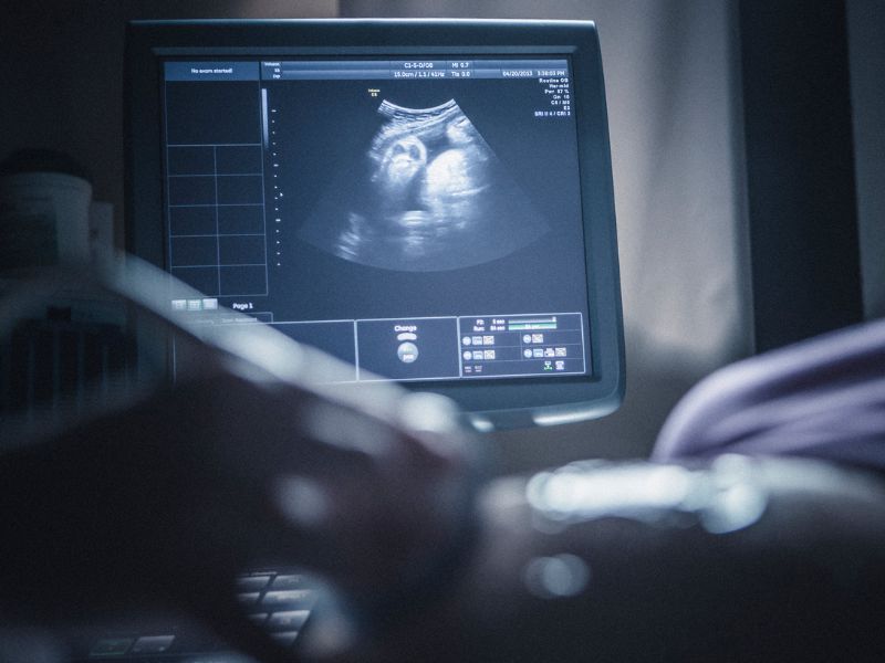 سونوگرافی‌های بارداری