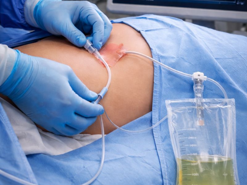 رادیولوژی مداخلهای درمانی رادیولوژی مداخلهای درمانی